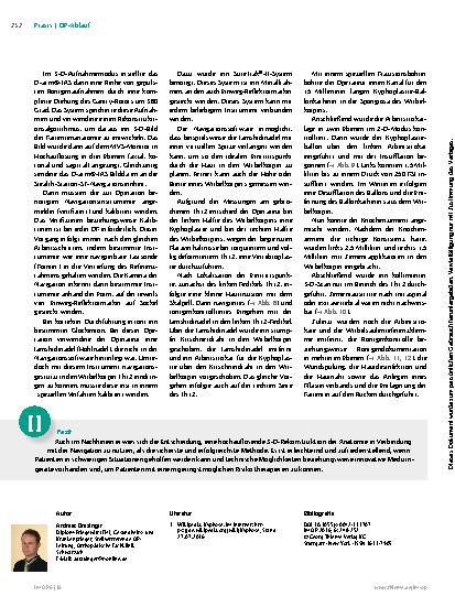 Vorschauseite 5: Navigierte Kyphoplastie