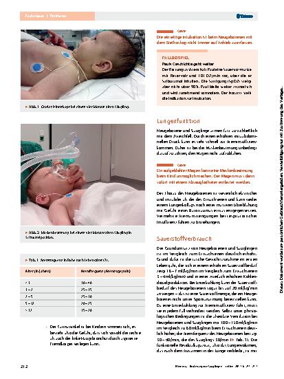 Vorschauseite 3: Beatmung von Säuglingen und Kleinkindern: Was ist besonders?