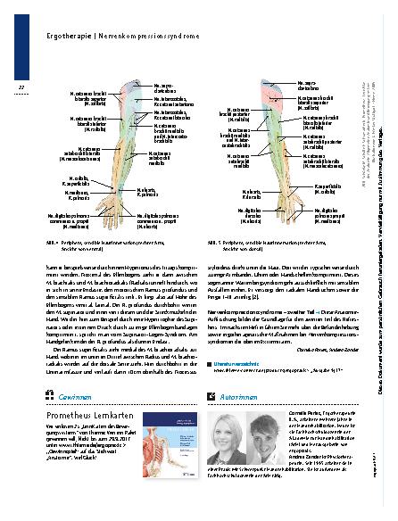 Vorschauseite 5: Nervenkompressionssyndrome – Wenn Nerven nerven