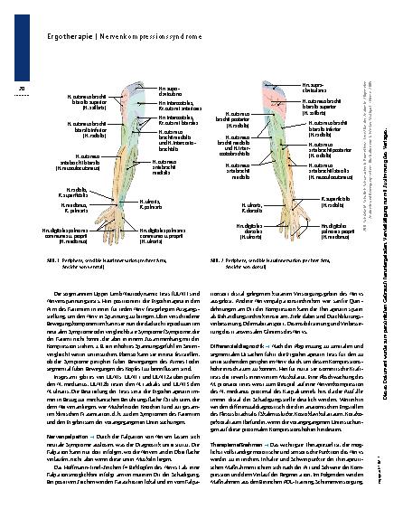 Vorschauseite 3: Nervenkompressionssyndrome – Wenn Nerven nerven