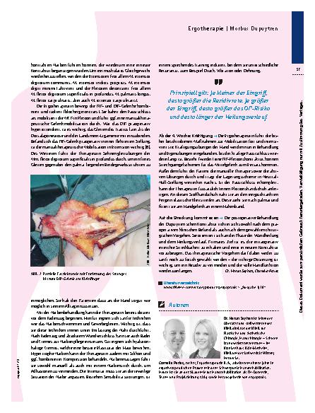 Vorschauseite 4: Ergotherapie bei Morbus Dupuytren – Auf die Streckung kommt es an