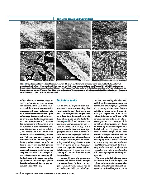 Vorschauseite 5: Wasser als Infektionsquelle in medizinischen Einrichtungen, Prävention und Kontrolle