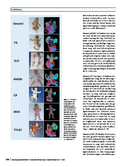 Vorschauseite 6: Analyse der Spontanmotorik im 1. Lebensjahr: Markerlose 3-D-Bewegungserfassung zur Früherkennung von Entwicklungsstörungen