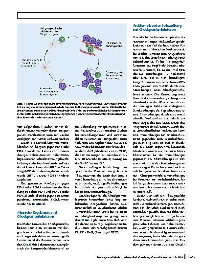 Vorschauseite 2: Checkpointinhibitoren in der Tumortherapie