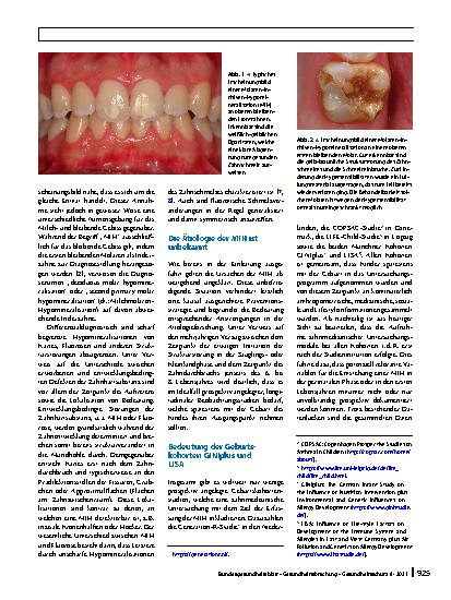 Vorschauseite 2: Molaren-Inzisiven-Hypomineralisation (MIH). Häufigkeit und mögliche Ursachen unter besonderer Berücksichtigung der Ergebnisse aus den Münchner Geburtskohorten GINIplus und LISA