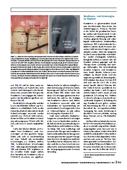 Vorschauseite 5: Parodontitis – Therapie einer Volkskrankheit