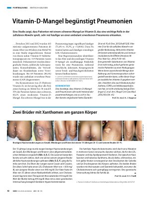 Vorschauseite 1: Vitamin-D-Mangel begünstigt Pneumonien