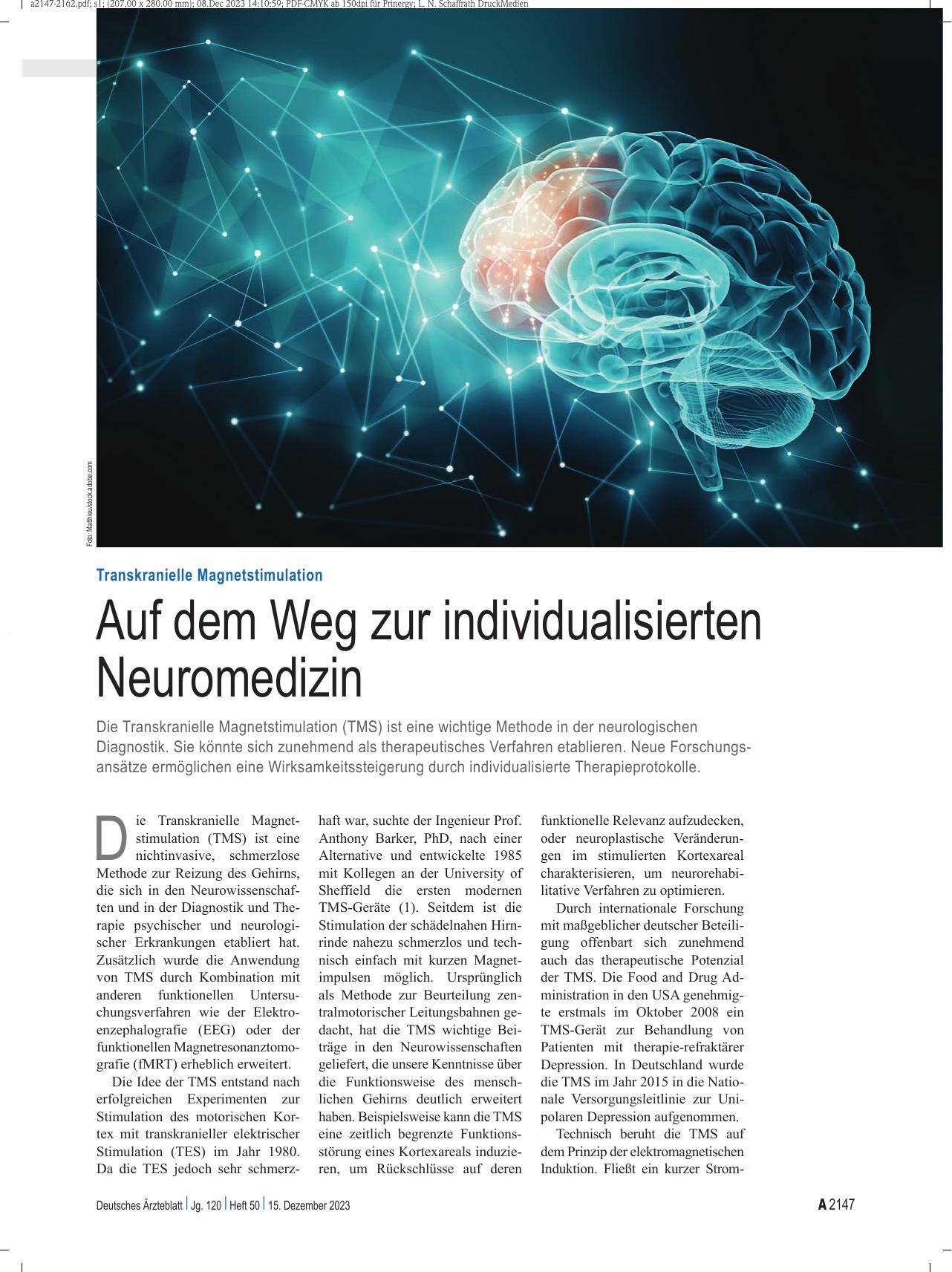 Vorschauseite 1: Transkranielle Magnetstimulation: Auf dem Weg zur individualisierten Neuromedizin