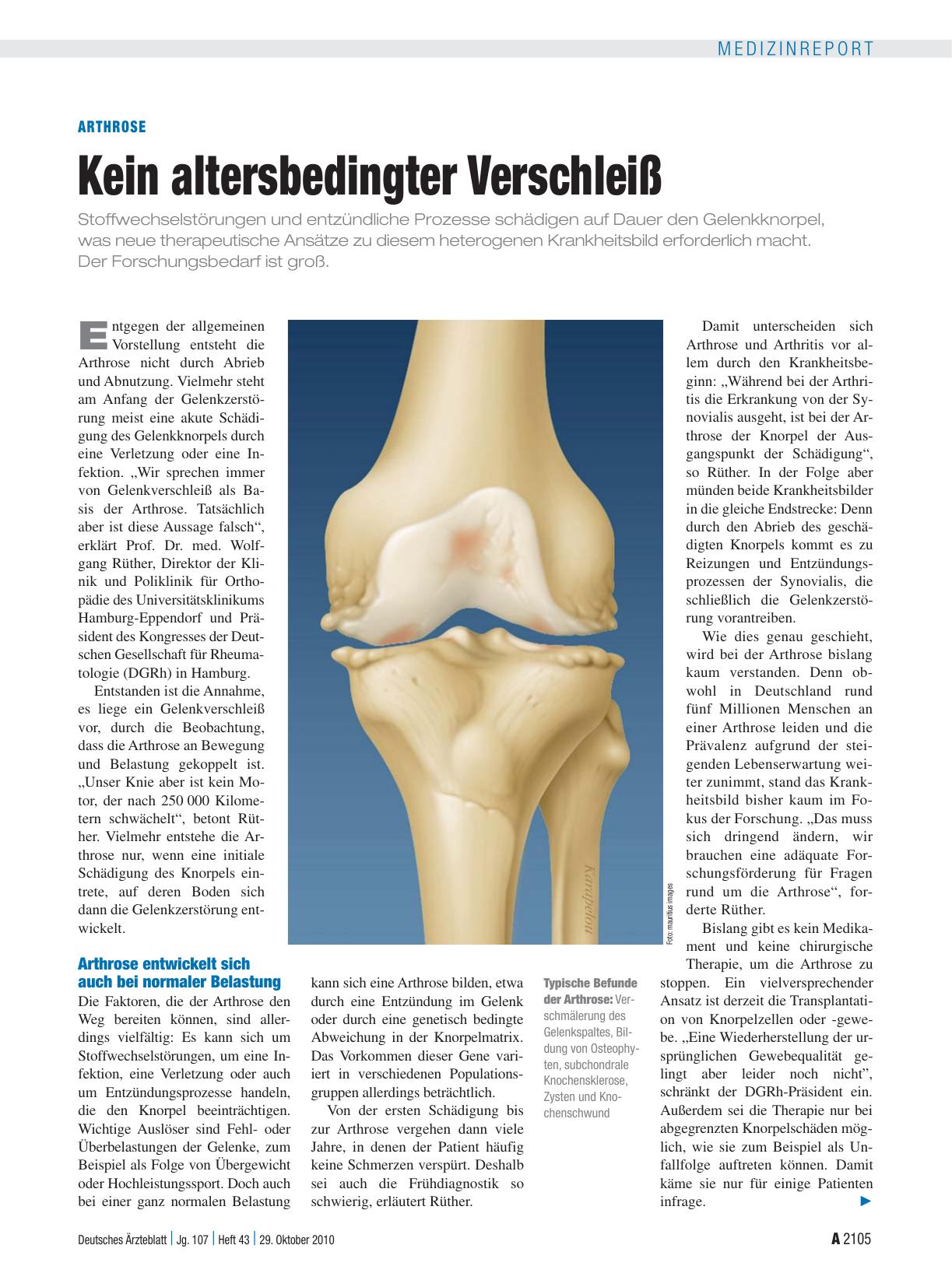 Vorschauseite 1: Arthrose: Kein altersbedingter Verschleiß