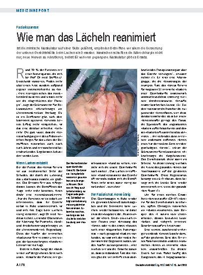 Vorschauseite 1: Fazialisparese: Wie man das Lächeln reanimiert