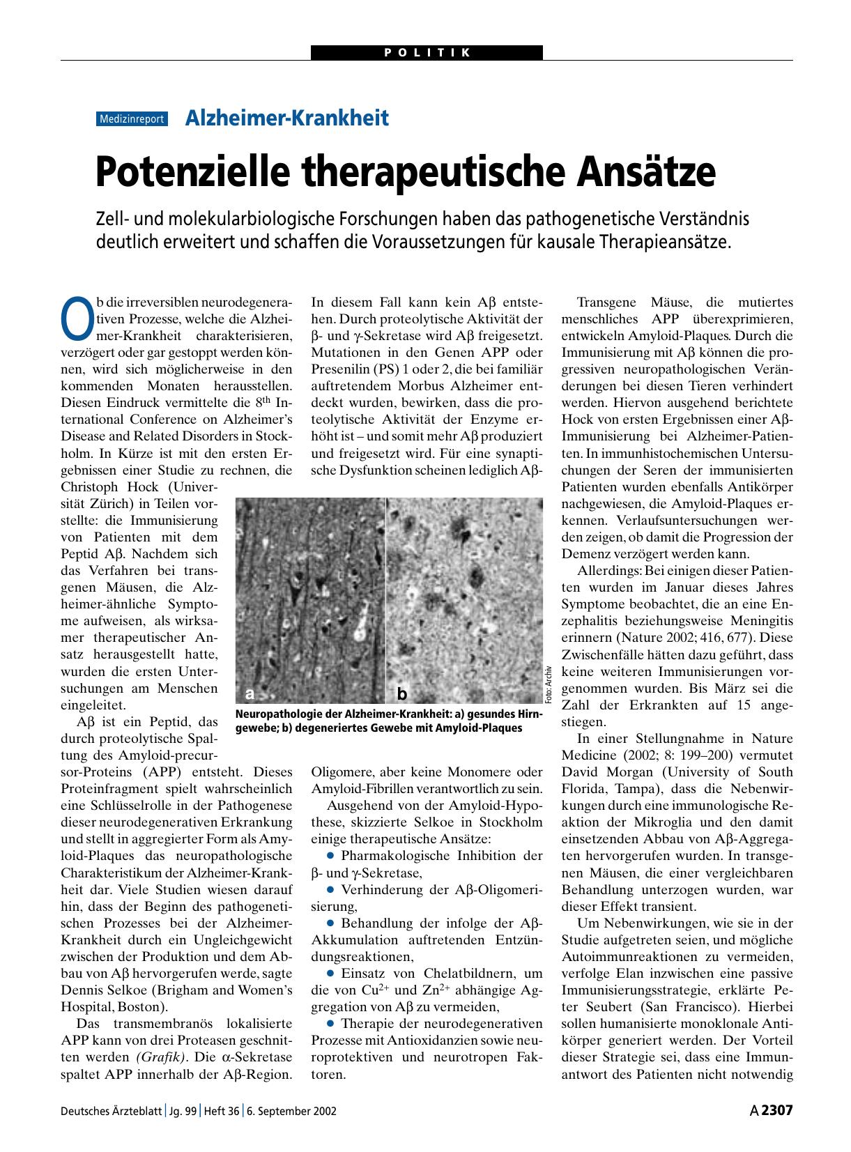 Vorschauseite 1: Alzheimer-Krankheit: Potenzielle therapeutische Ansätze