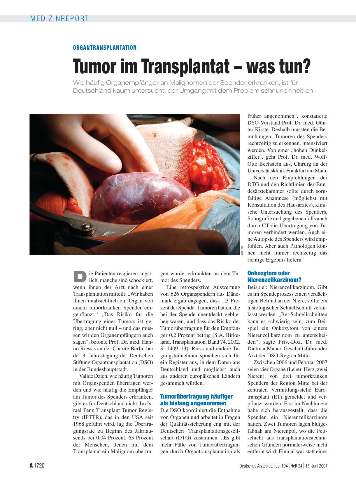 Vorschauseite 1: Organtransplantation: Tumor im Transplantat – was tun?
