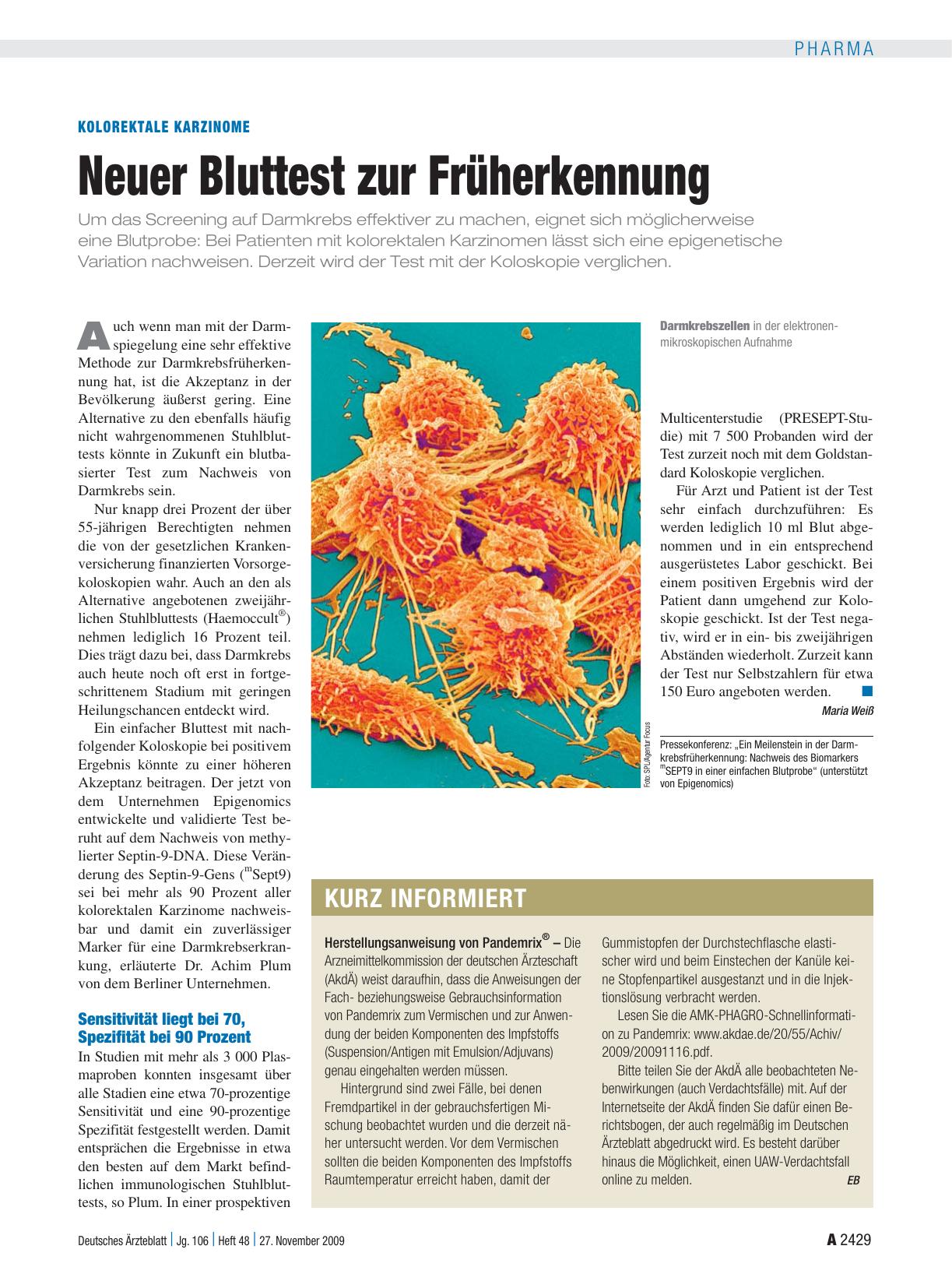 Vorschauseite 1: Kolorektale Karzinome: Neuer Bluttest zur Früherkennung