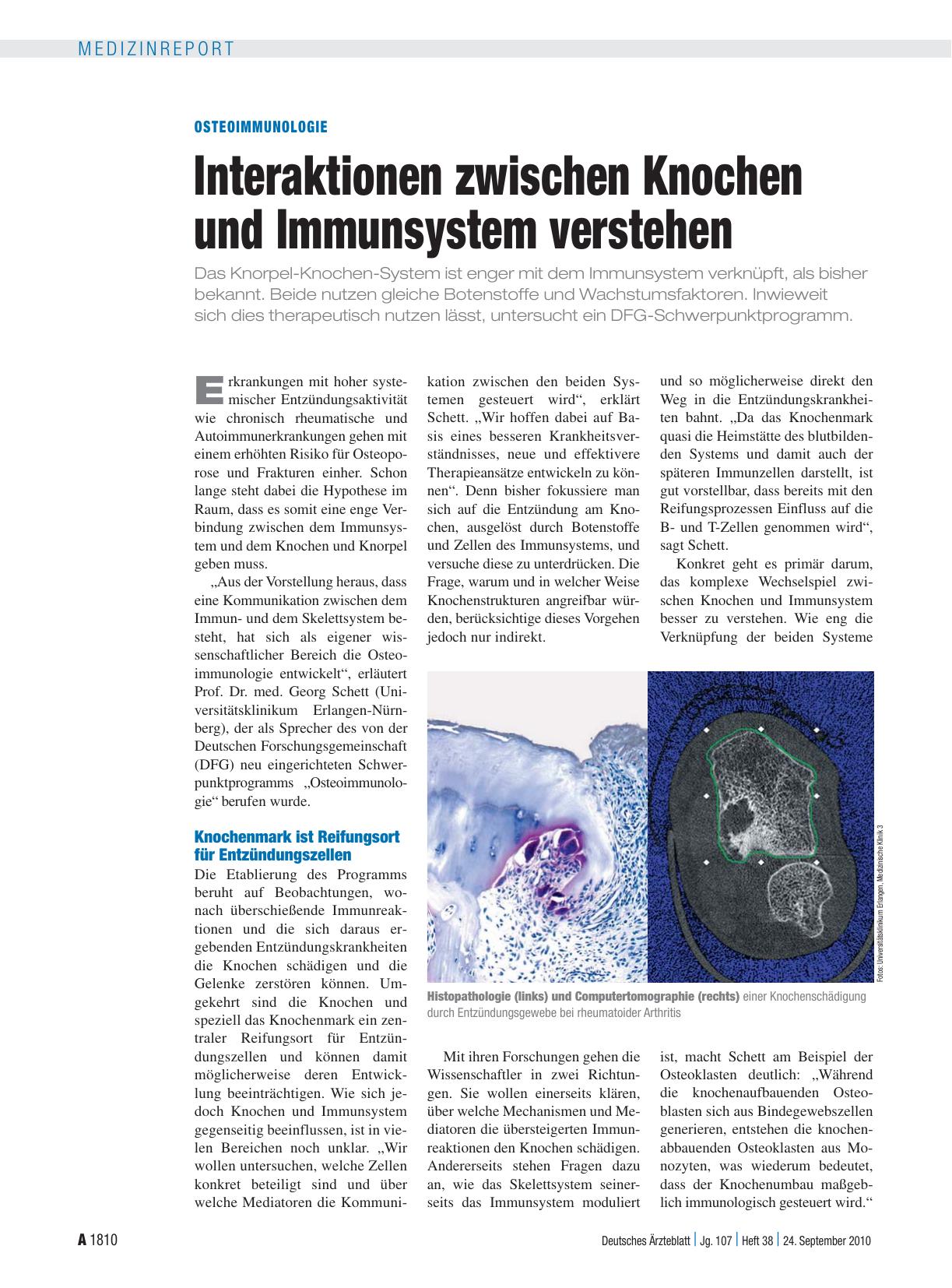Vorschauseite 1: Osteoimmunologie: Interaktionen zwischen Knochen und Immunsystem verstehen