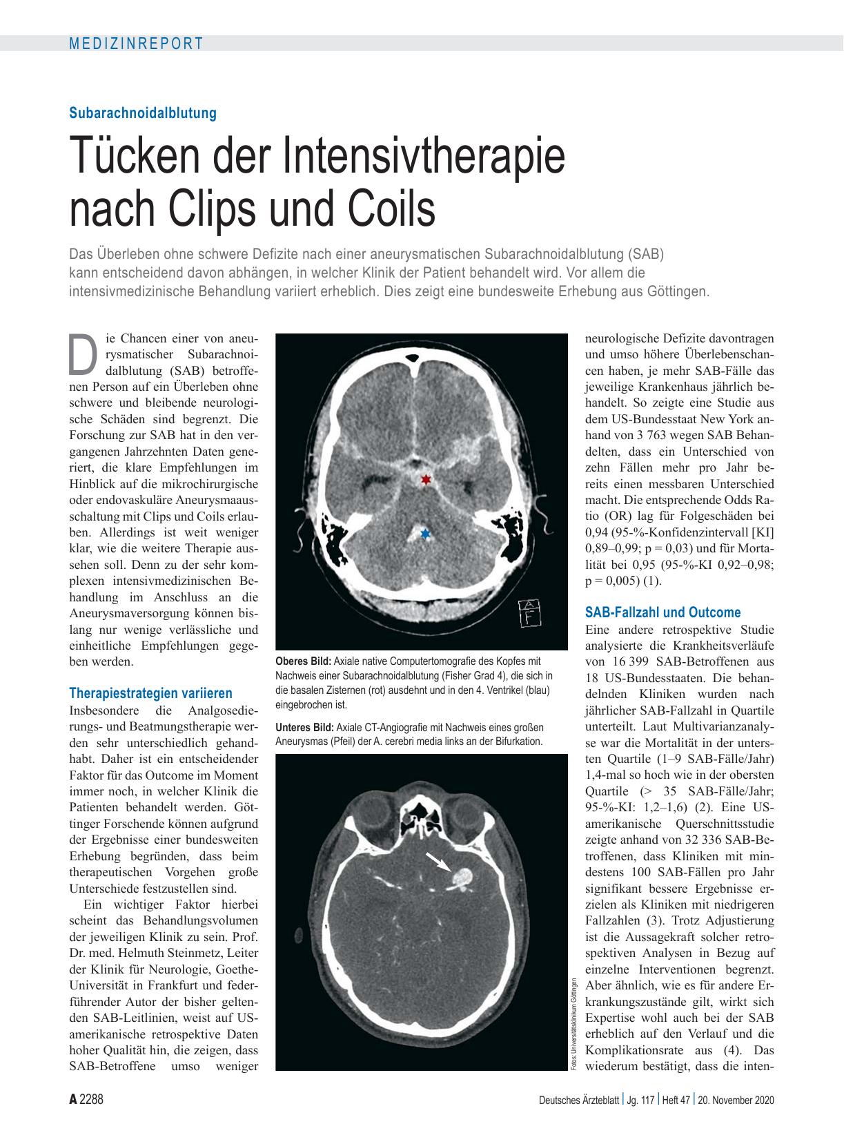 Vorschauseite 1: Subarachnoidalblutung: Tücken der Intensivtherapie nach Clips und Coils