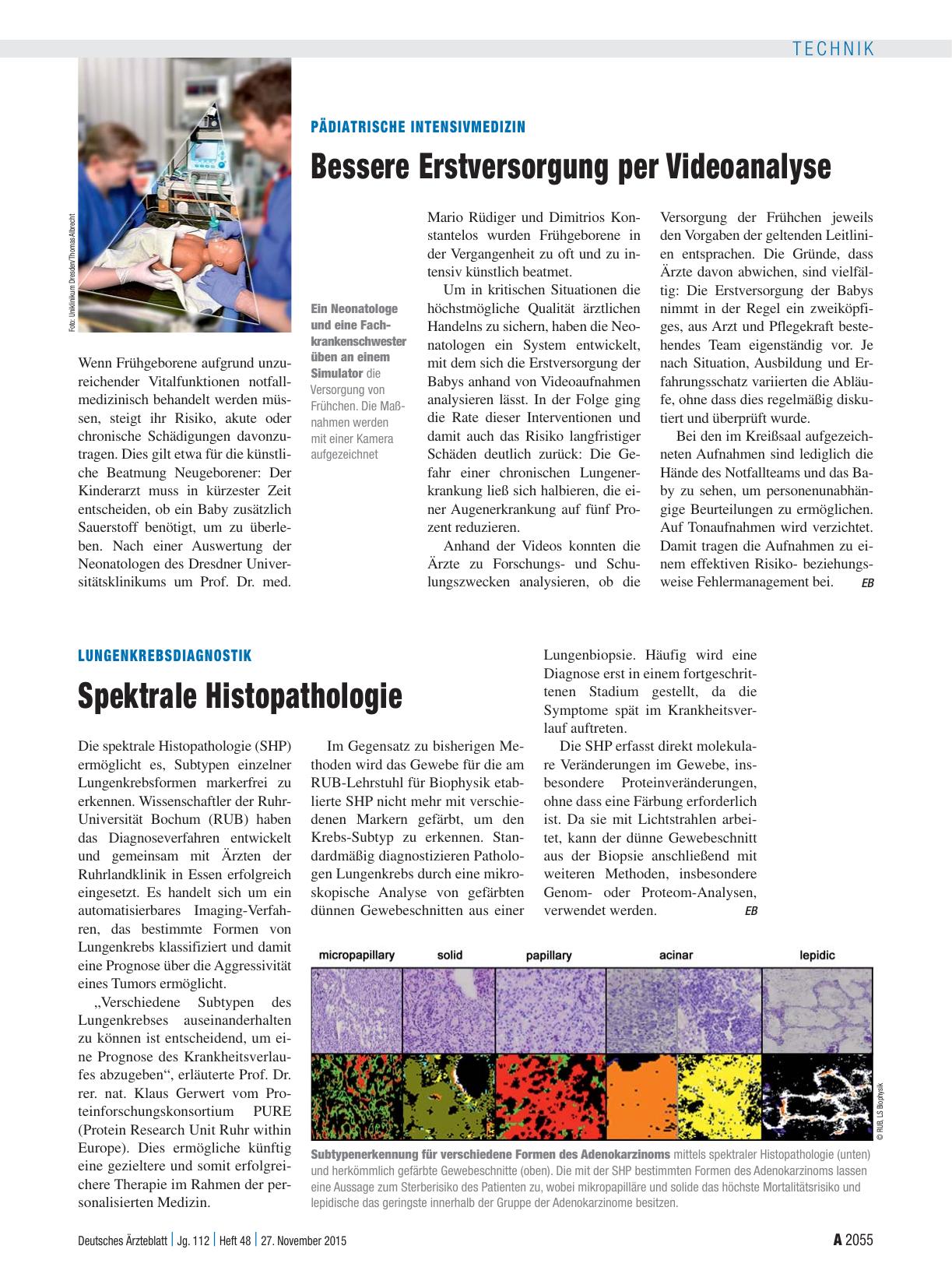 Vorschauseite 1: Lungenkrebsdiagnostik: Spektrale Histopathologie