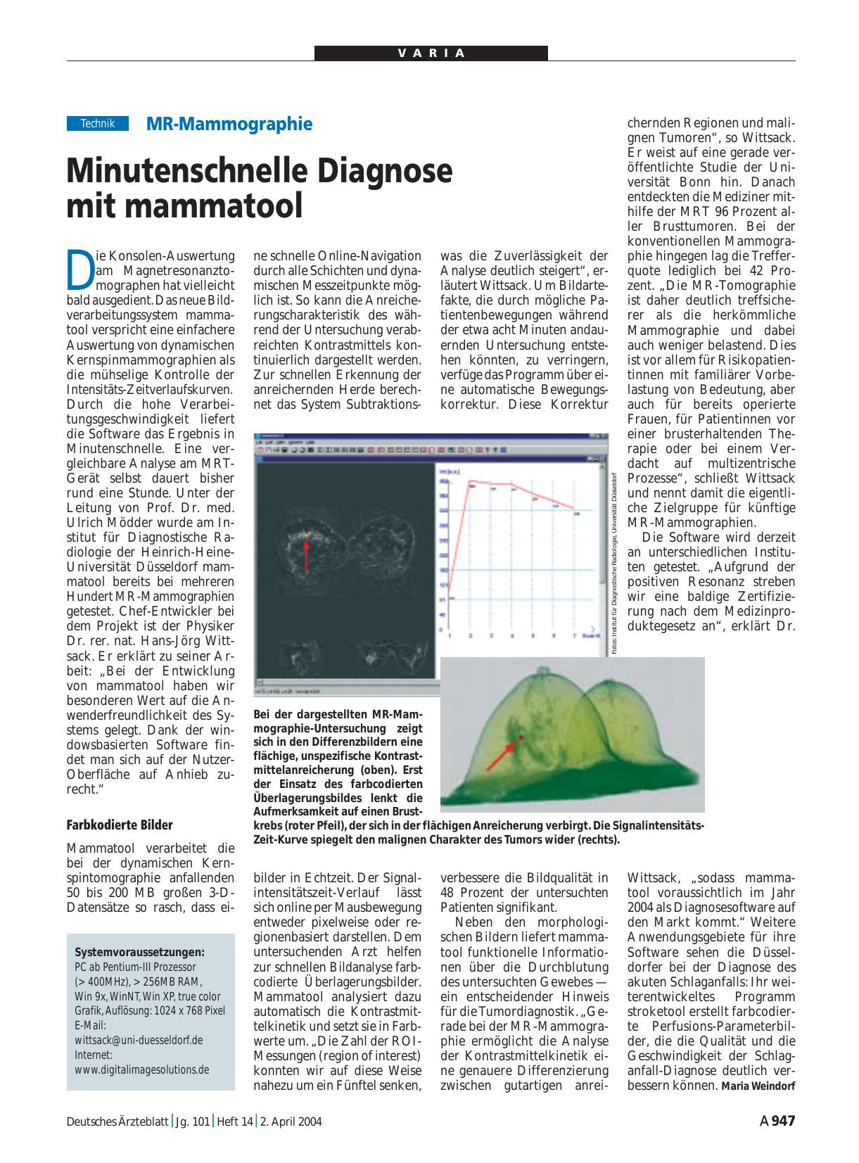 Vorschauseite 1: MR-Mammographie: Minutenschnelle Diagnose mit mammatool