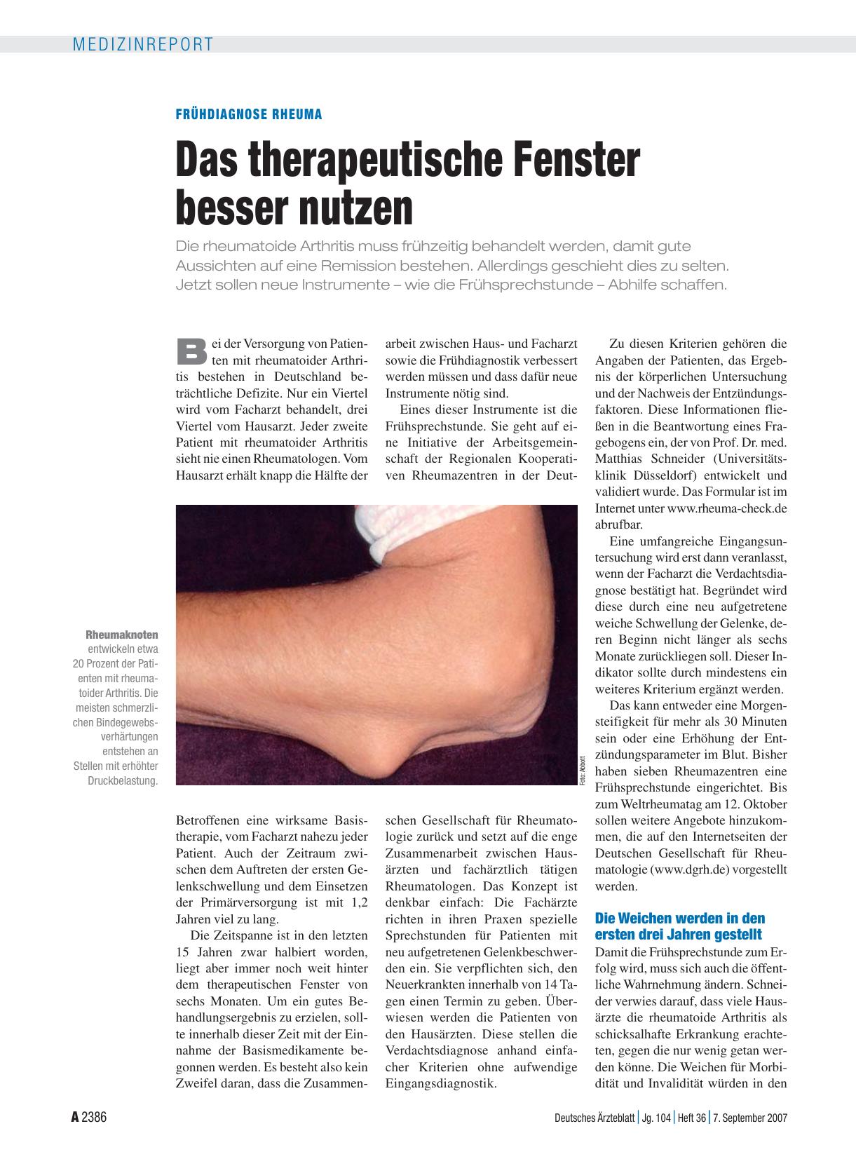 Vorschauseite 1: Frühdiagnose Rheuma: Das therapeutische Fenster besser nutzen