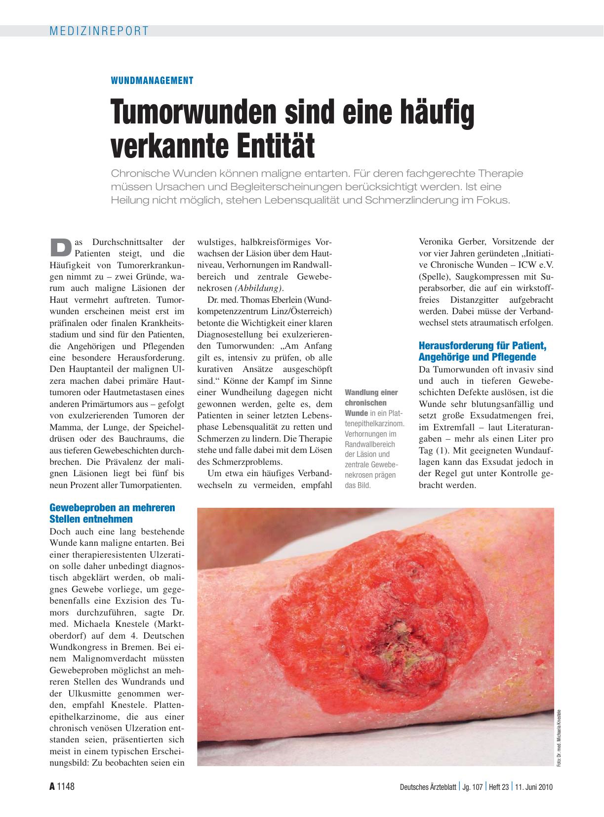 Vorschauseite 1: Wundmanagement: Tumorwunden sind eine häufig verkannte Entität