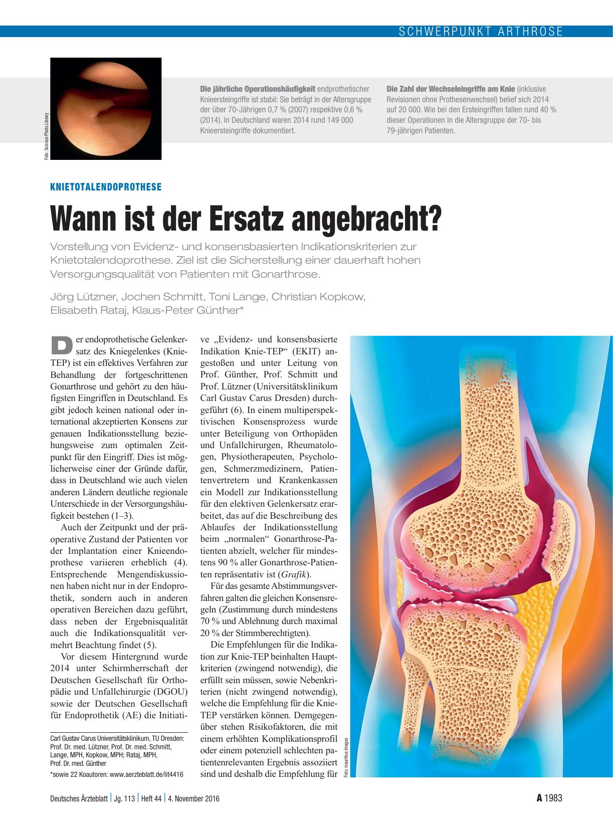 Vorschauseite 1: Knietotalendoprothese: Wann ist der Ersatz angebracht?