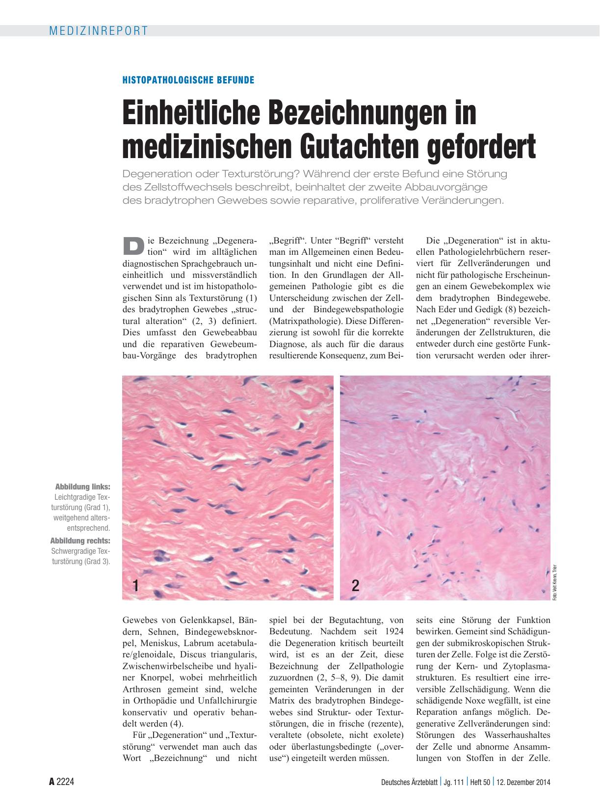 Vorschauseite 1: Histopathologische Befunde: Einheitliche Bezeichnungen in medizinischen Gutachten gefordert