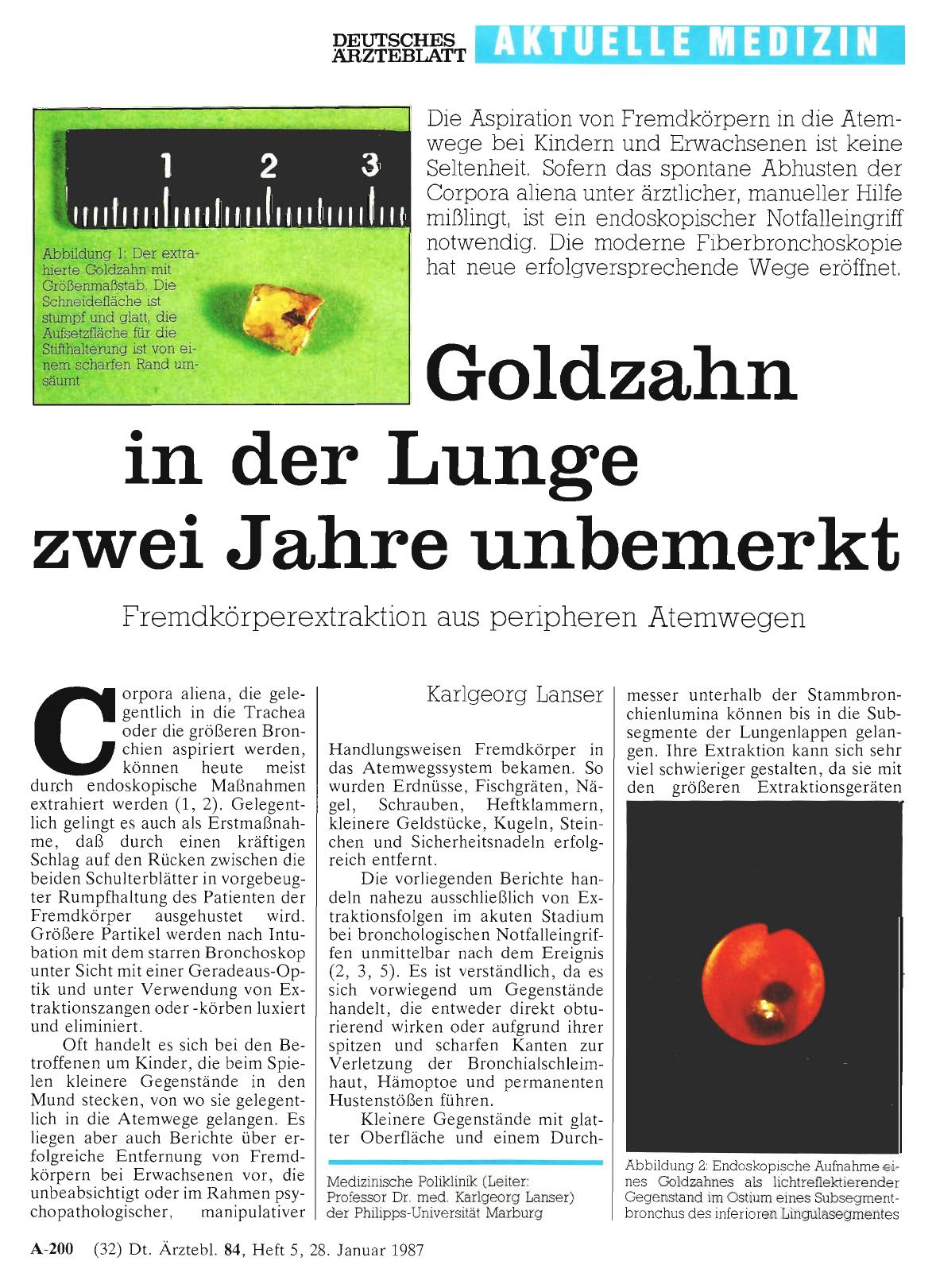 Vorschauseite 1: Goldzahn in der Lunge zwei Jahre unbemerkt