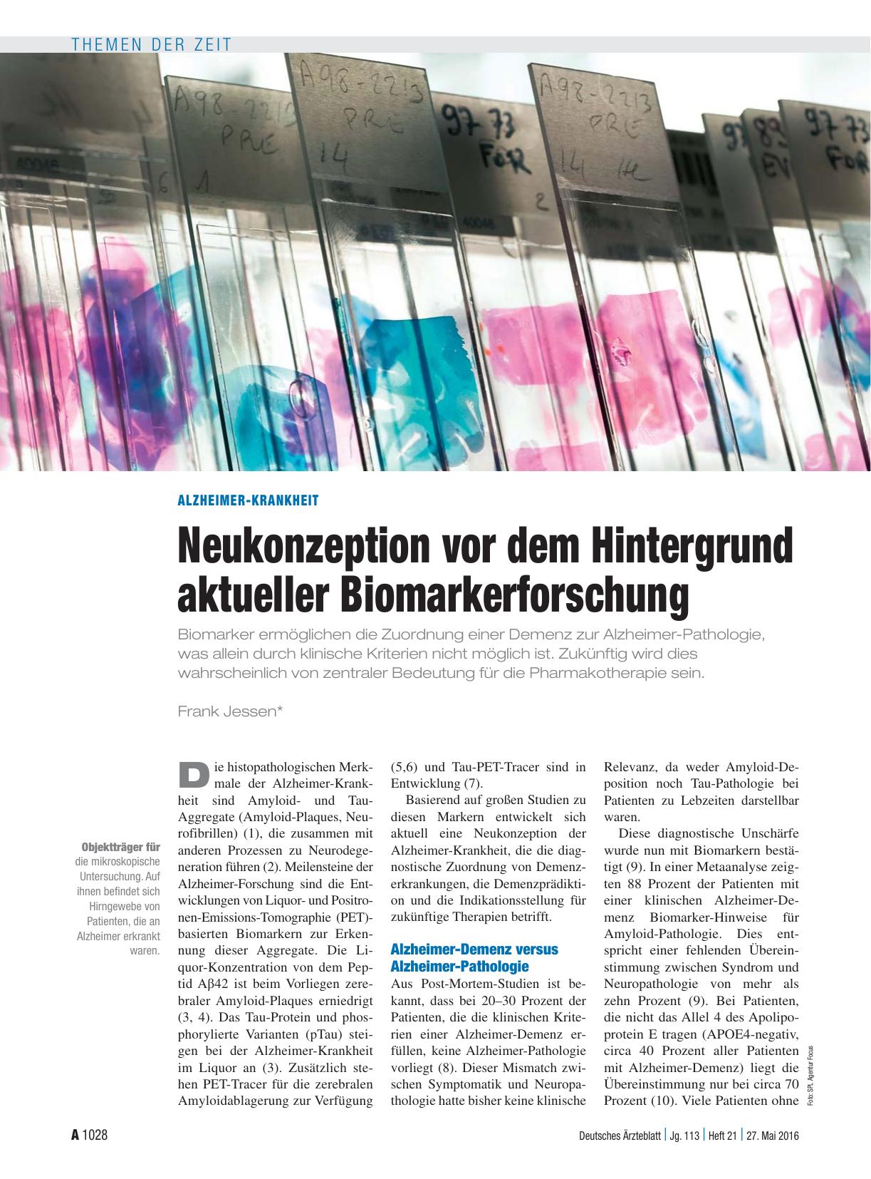 Vorschauseite 1: Alzheimer-Krankheit: Neukonzeption vor dem Hintergrund aktueller Biomarkerforschung