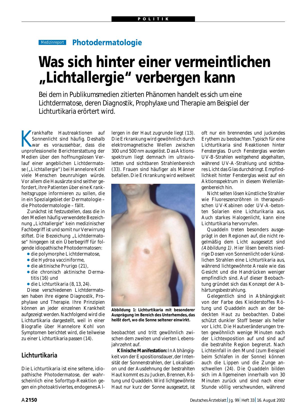 Vorschauseite 1: Photodermatologie: Was sich hinter einer vermeintlichen „Lichtallergie“ verbergen kann