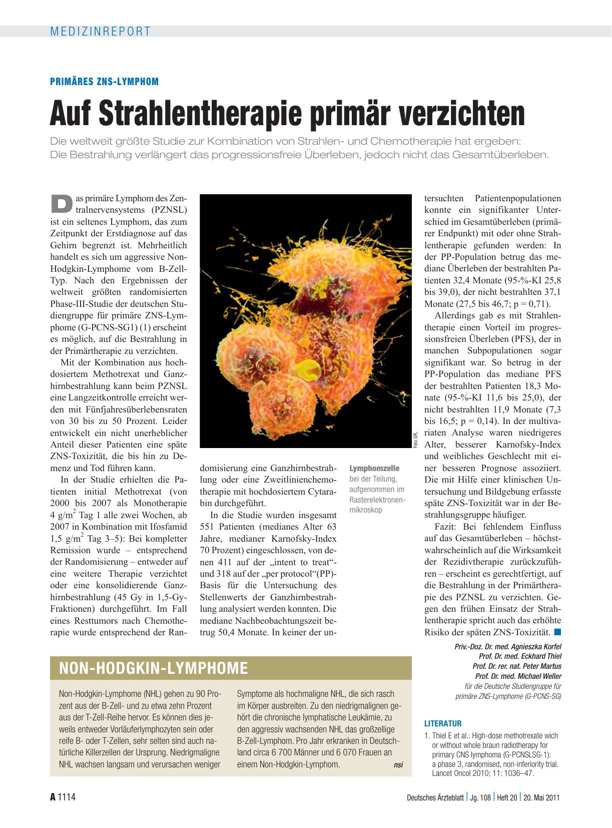 Vorschauseite 1: Primäres ZNS-Lymphom: Auf Strahlentherapie primär verzichten