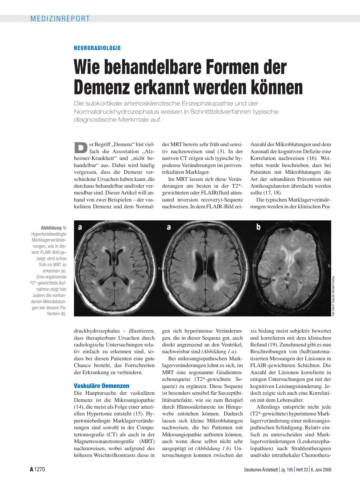 Vorschauseite 1: Neuroradiologie: Wie behandelbare Formen der Demenz erkannt werden können