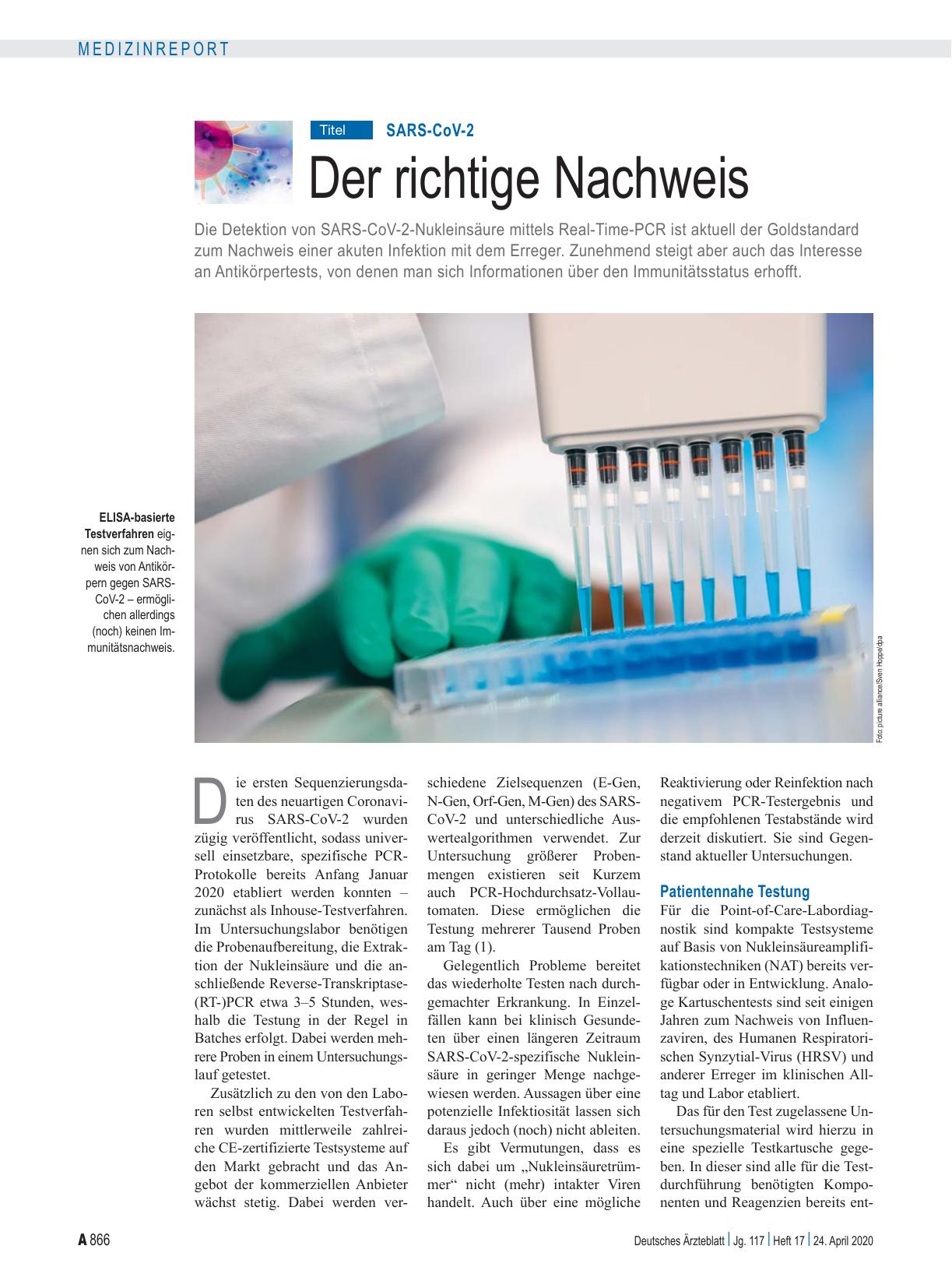 Vorschauseite 1: SARS-CoV-2: Der richtige Nachweis