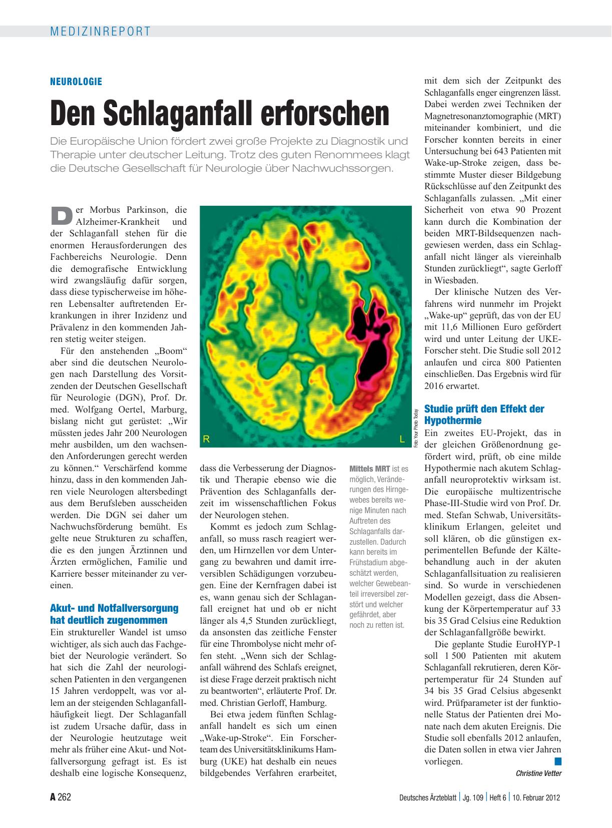 Vorschauseite 1: Neurologie: Den Schlaganfall erforschen