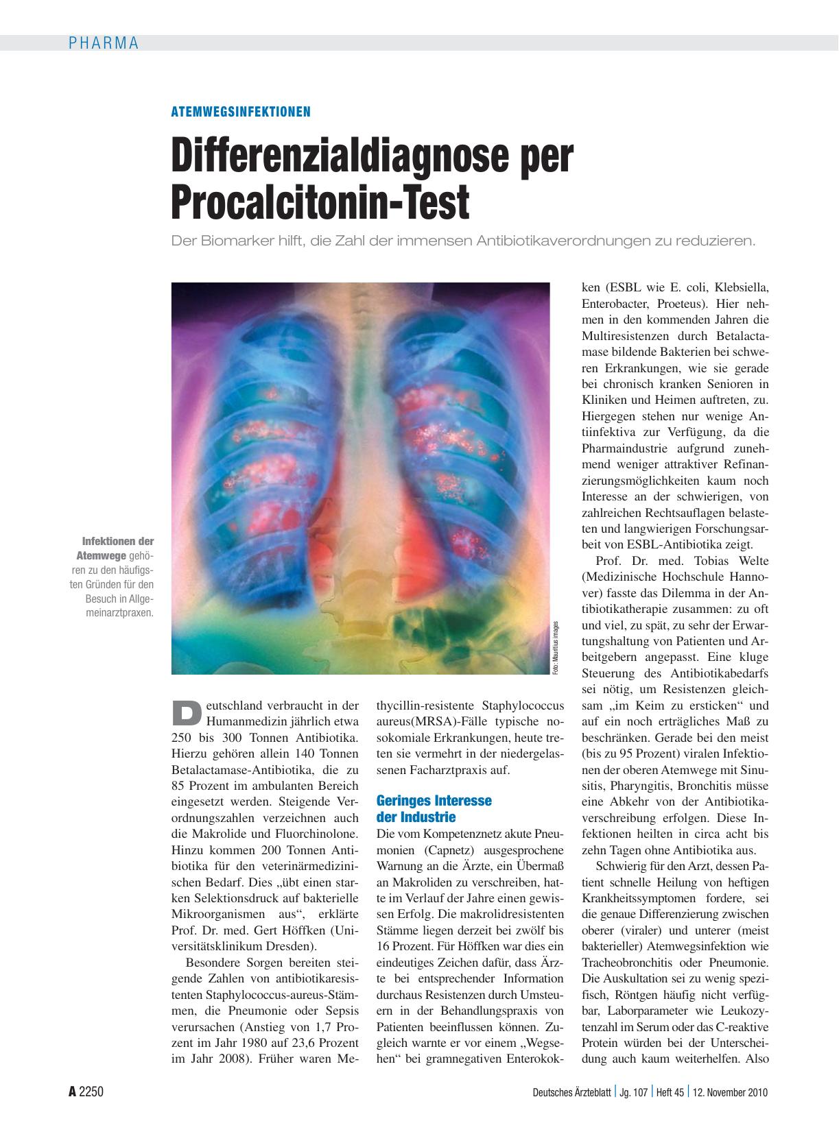 Vorschauseite 1: Atemwegsinfektionen: Differenzialdiagnose per Procalcitonin-Test