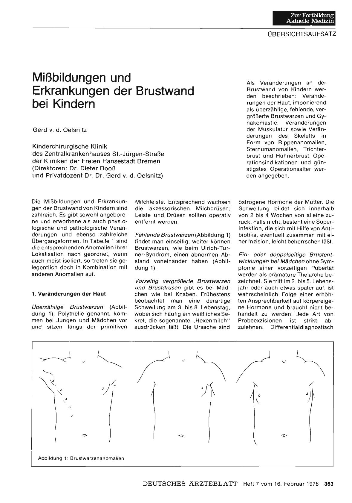 Vorschauseite 1: Mißbildungen und Erkrankungen der Brustwand bei Kindern