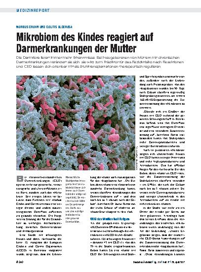 Vorschauseite 1: Morbus Crohn und Colitis Ulcerosa: Mikrobiom des Kindes reagiert auf Darmerkrankungen der Mutter