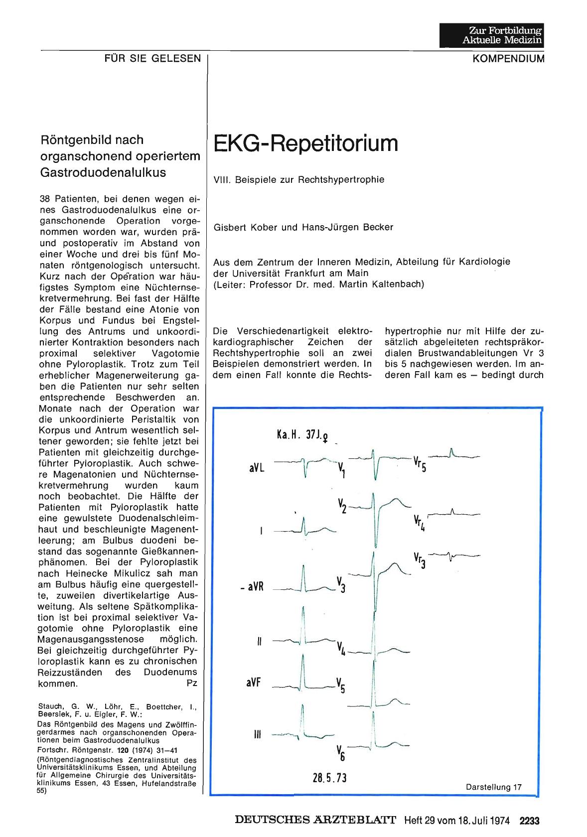 Vorschauseite 1: EKG-Repetitorium: VIII. Beispiele zur Rechtshypertrophie