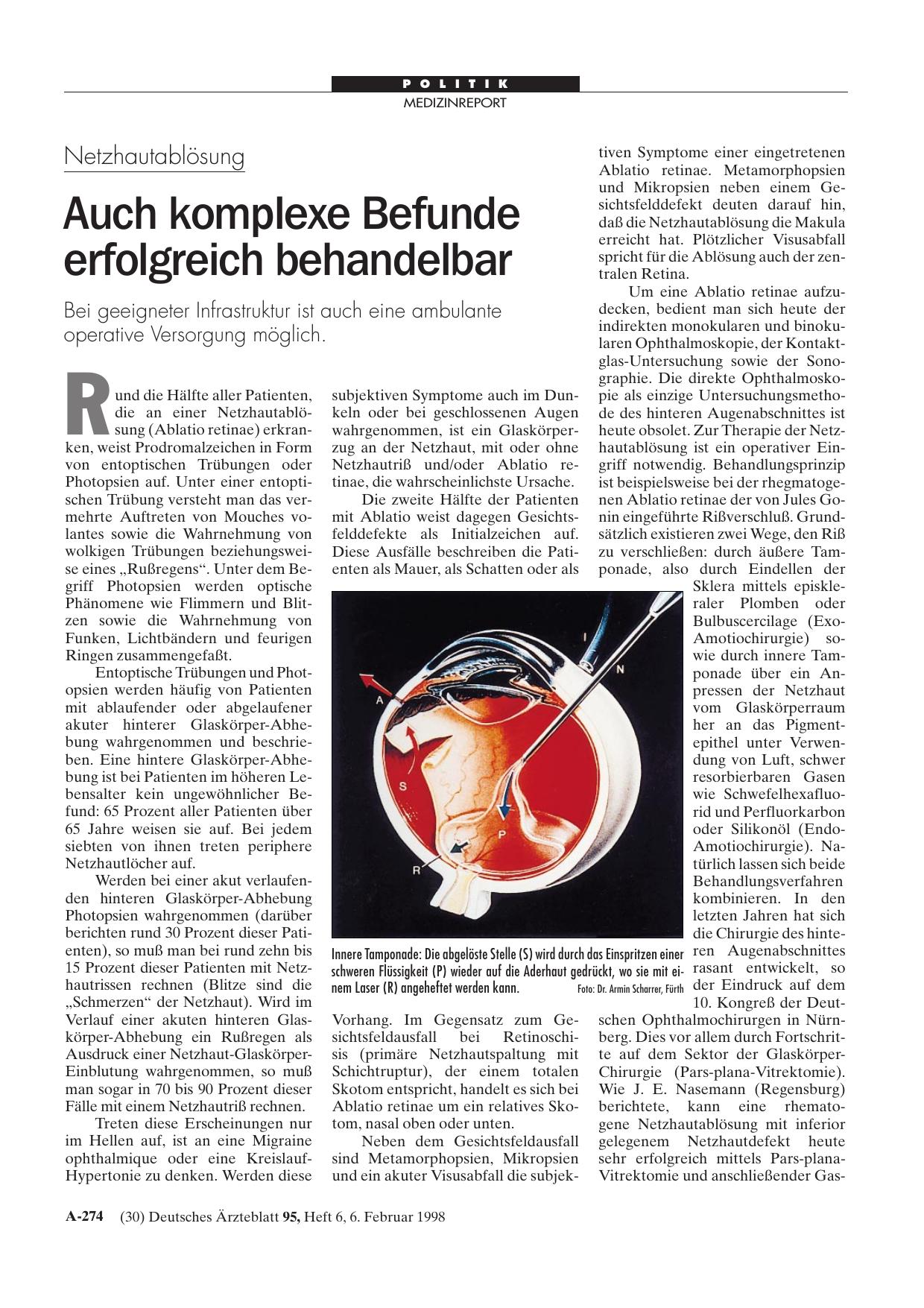 Vorschauseite 1: Netzhautablösung: Auch komplexe Befunde erfolgreich behandelbar