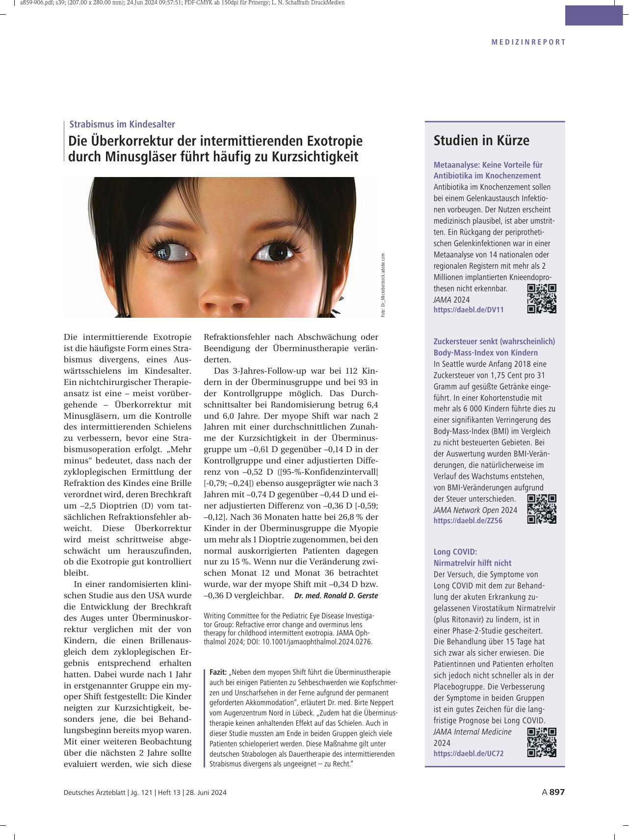 Vorschauseite 1: Strabismus im Kindesalter: Die Überkorrektur der intermittierenden Exotropie durch Minusgläser führt häufig zu Kurzsichtigkeit.