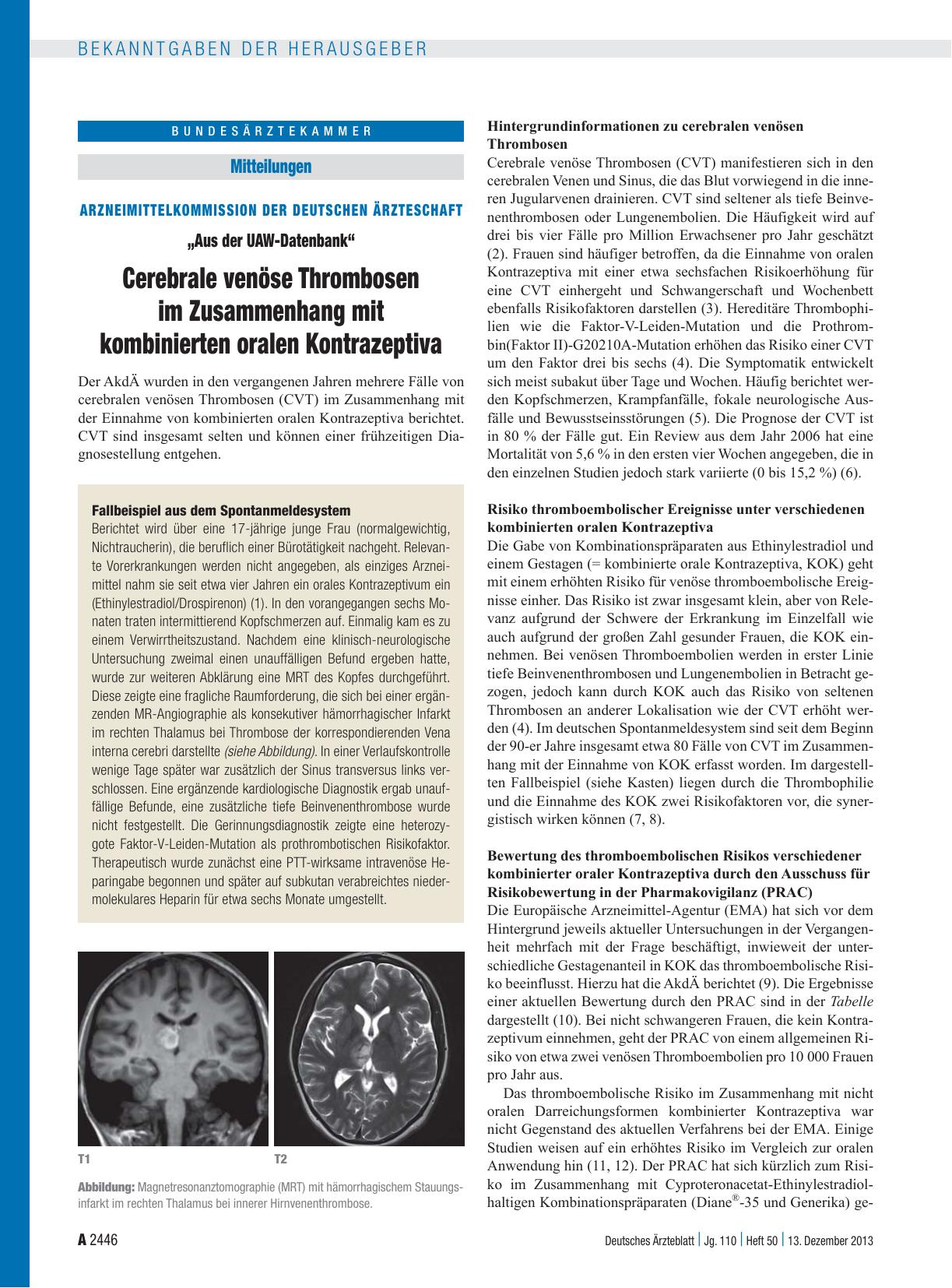 Vorschauseite 1: Arzneimittelkommission der Deutschen Ärzteschaft: „Aus der UAW-Datenbank“ – Cerebrale venöse Thrombosen im Zusammenhang mit kombinierten oralen Kontrazeptiva
