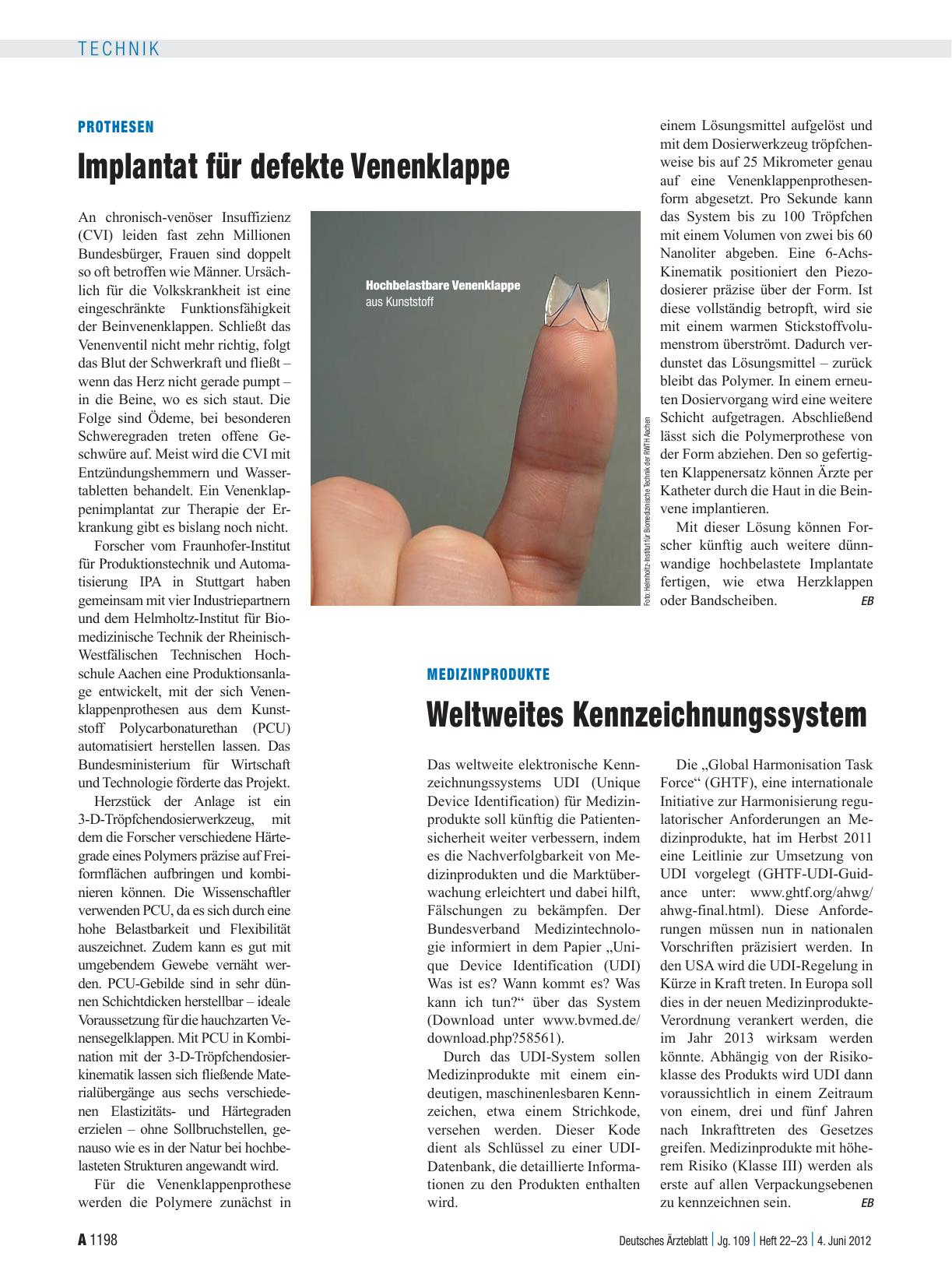 Vorschauseite 1: Prothesen: Implantat für defekte Venenklappe