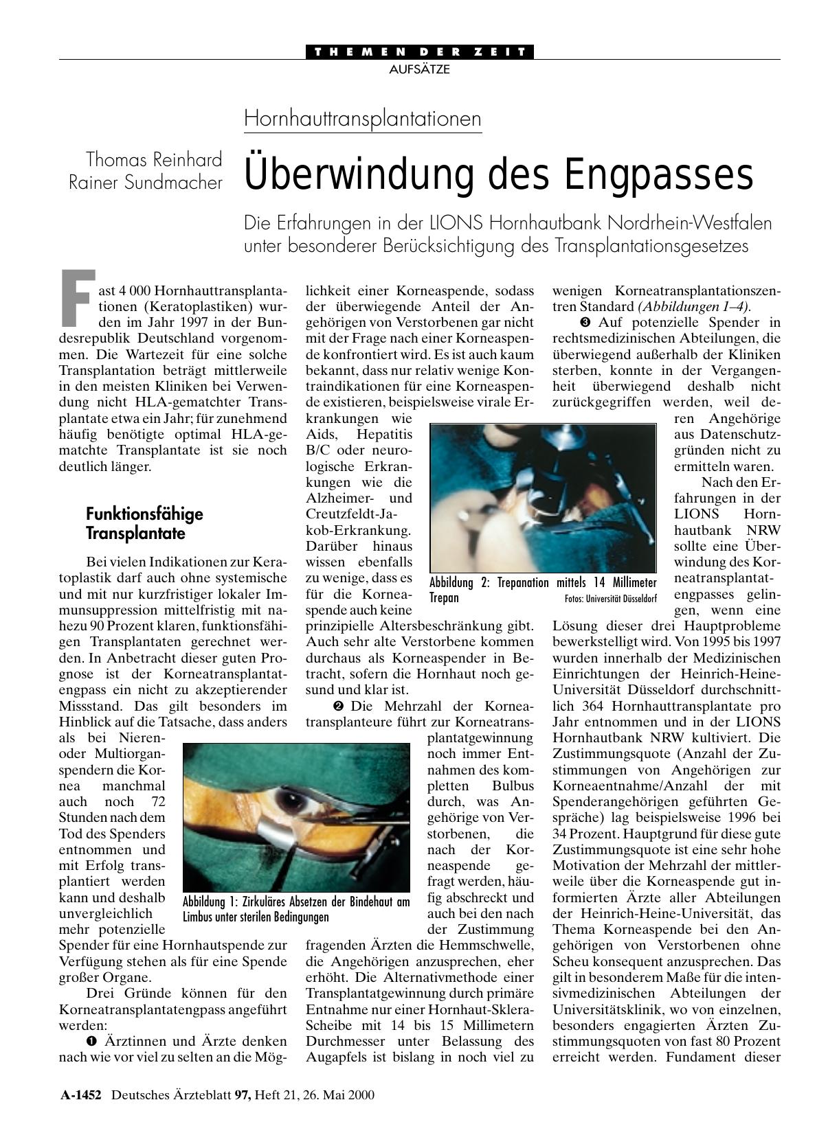 Vorschauseite 1: Hornhauttransplantationen: Überwindung des Engpasses