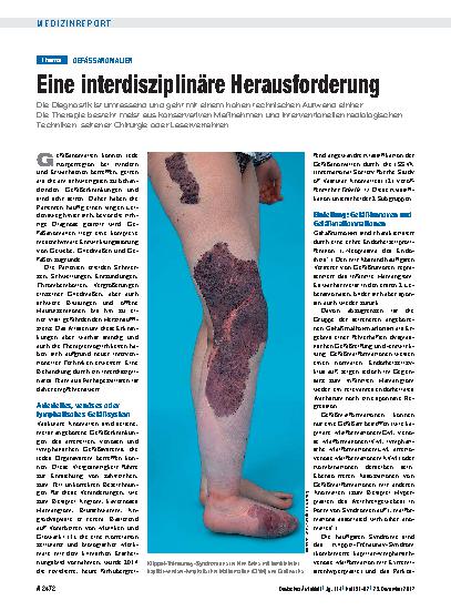 Vorschauseite 1: Gefäßanomalien: Eine interdisziplinäre Herausforderung