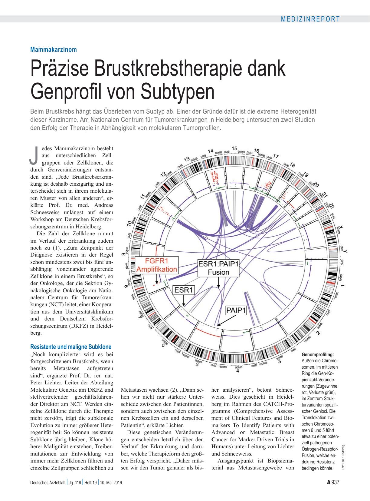 Vorschauseite 1: Mammakarzinom: Präzise Brustkrebstherapie dank Genprofil von Subtypen