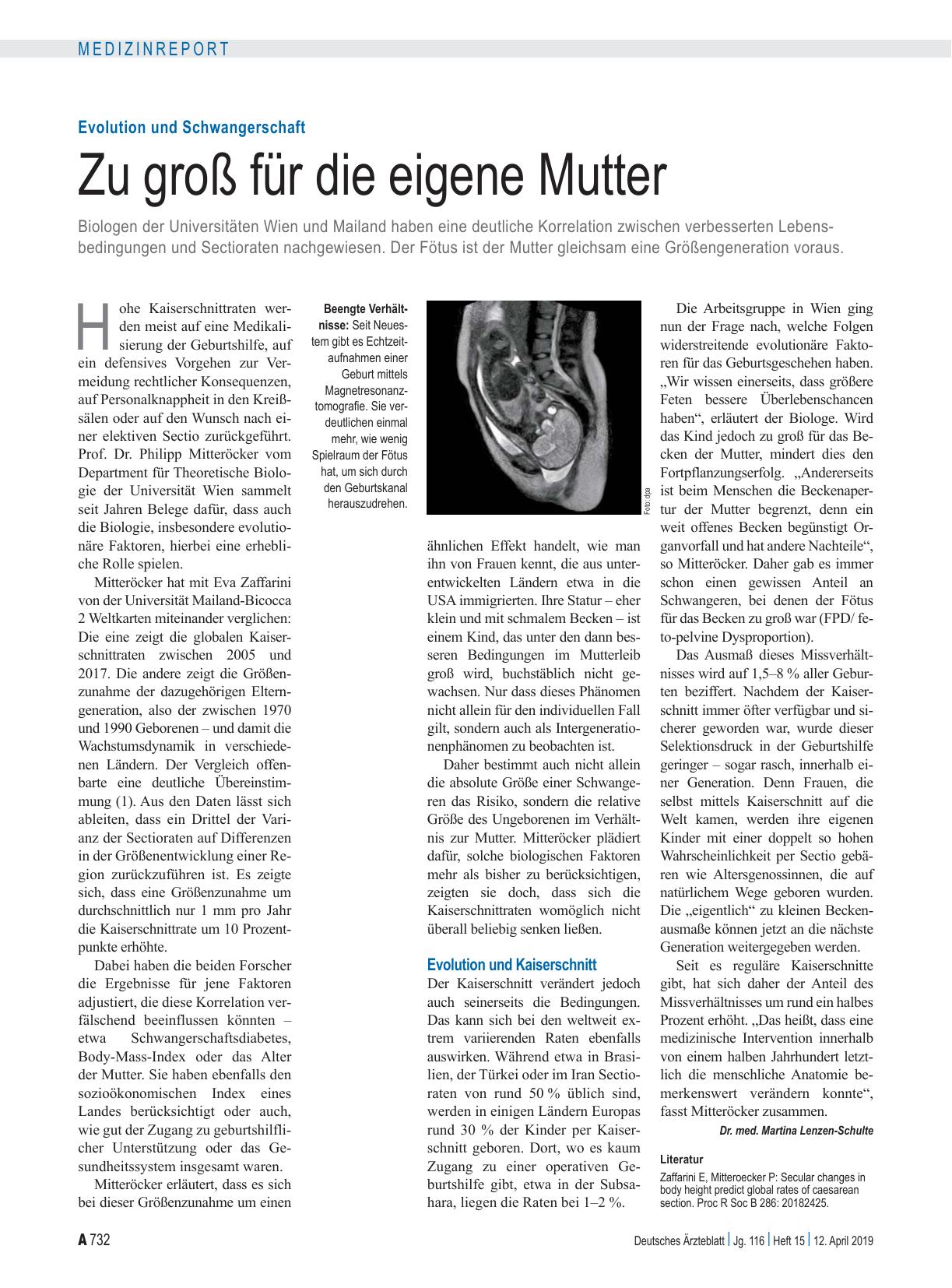 Vorschauseite 1: Evolution und Schwangerschaft: Zu groß für die eigene Mutter