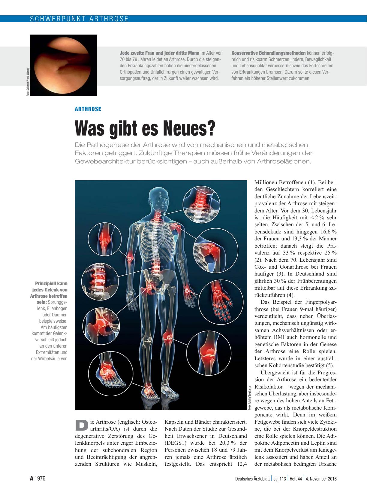 Vorschauseite 1: Arthrose: Was gibt es Neues?