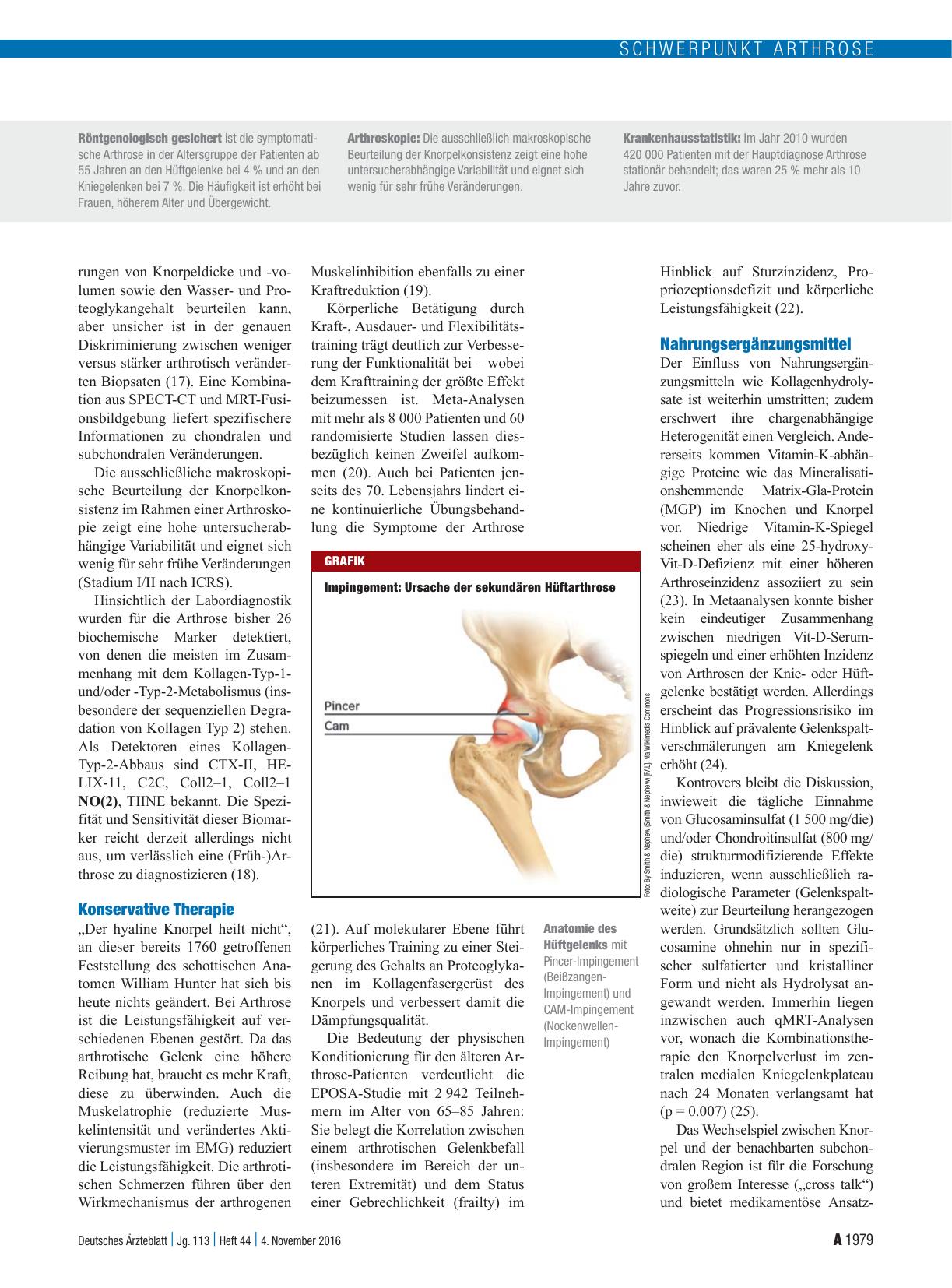 Vorschauseite 3: Arthrose: Was gibt es Neues?