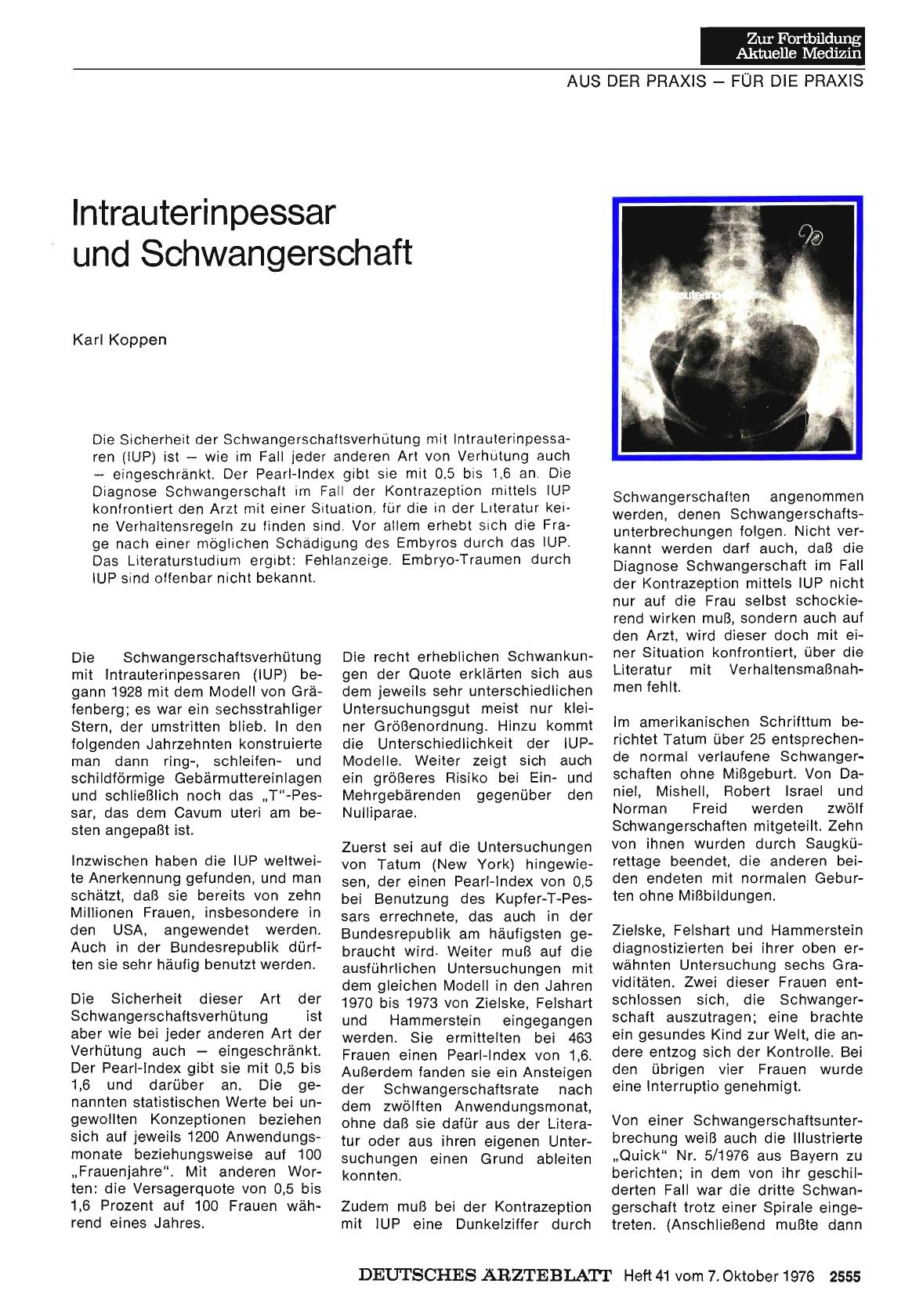 Vorschauseite 1: Intrauterinpessar und Schwangerschaft