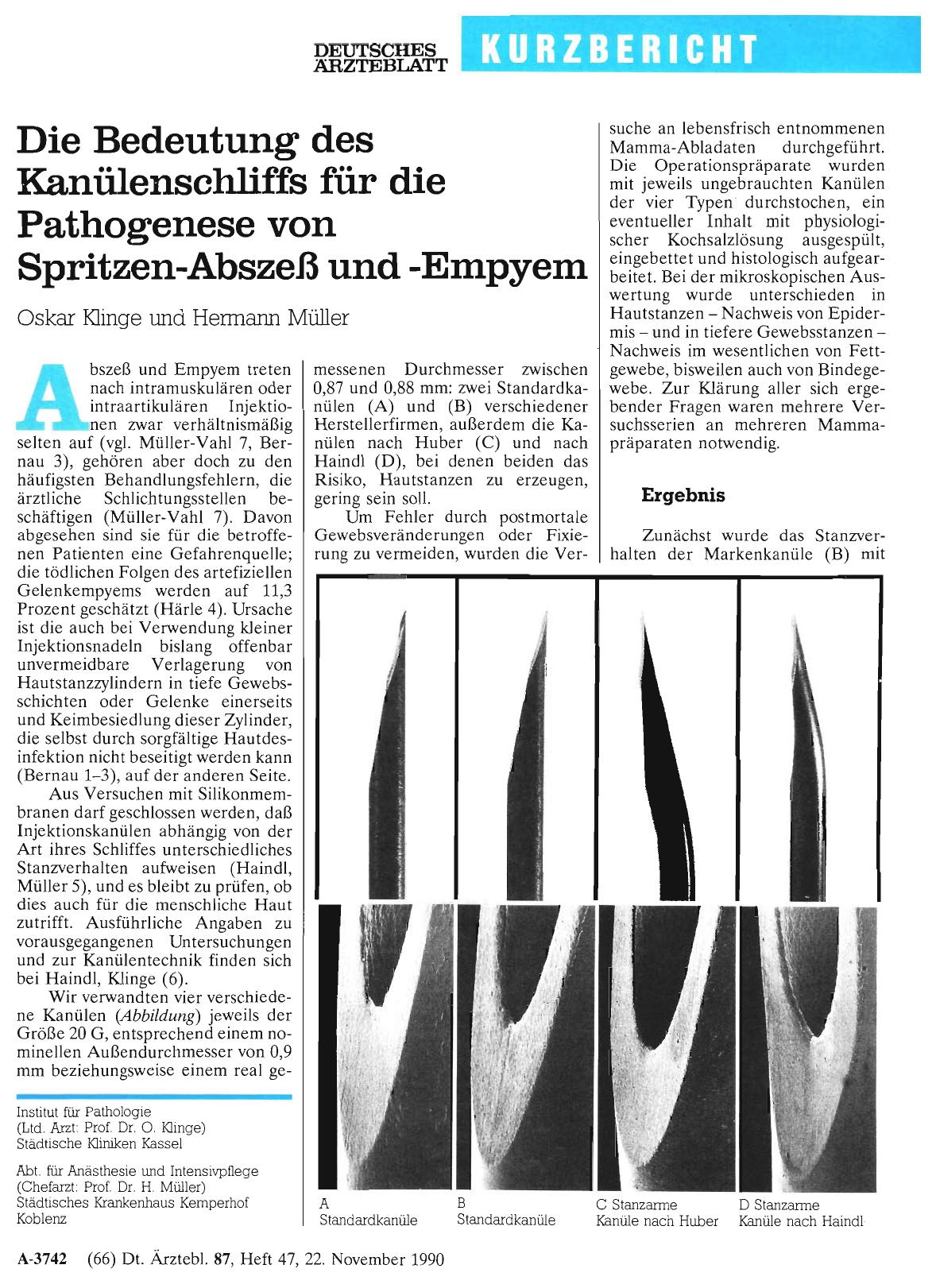 Vorschauseite 1: Die Bedeutung des Kanülenschliffs für die Pathogenese von Spritzen-Abszeß und -Empyem