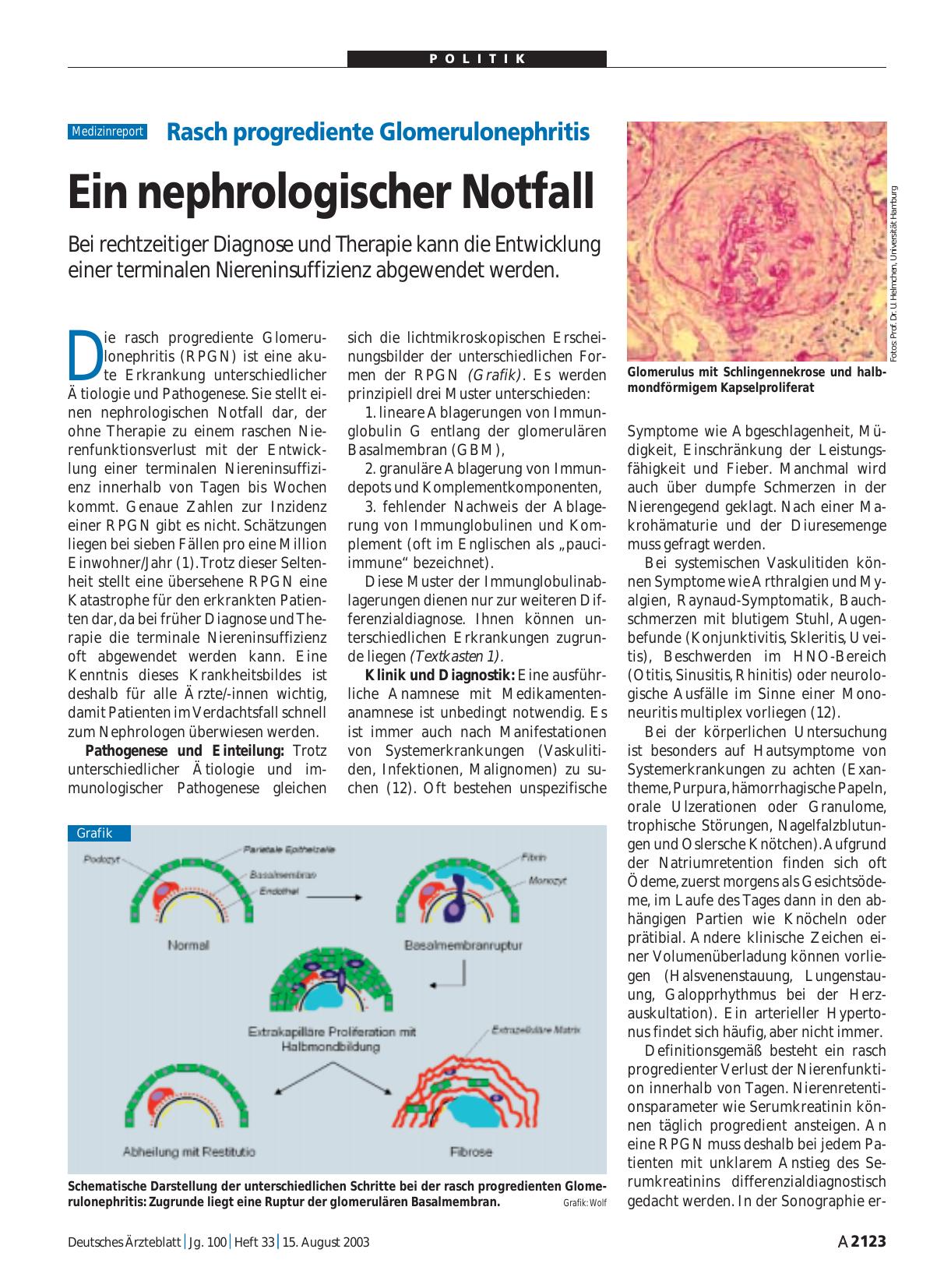 Vorschauseite 1: Rasch progrediente Glomerulonephritis: Ein nephrologischer Notfall