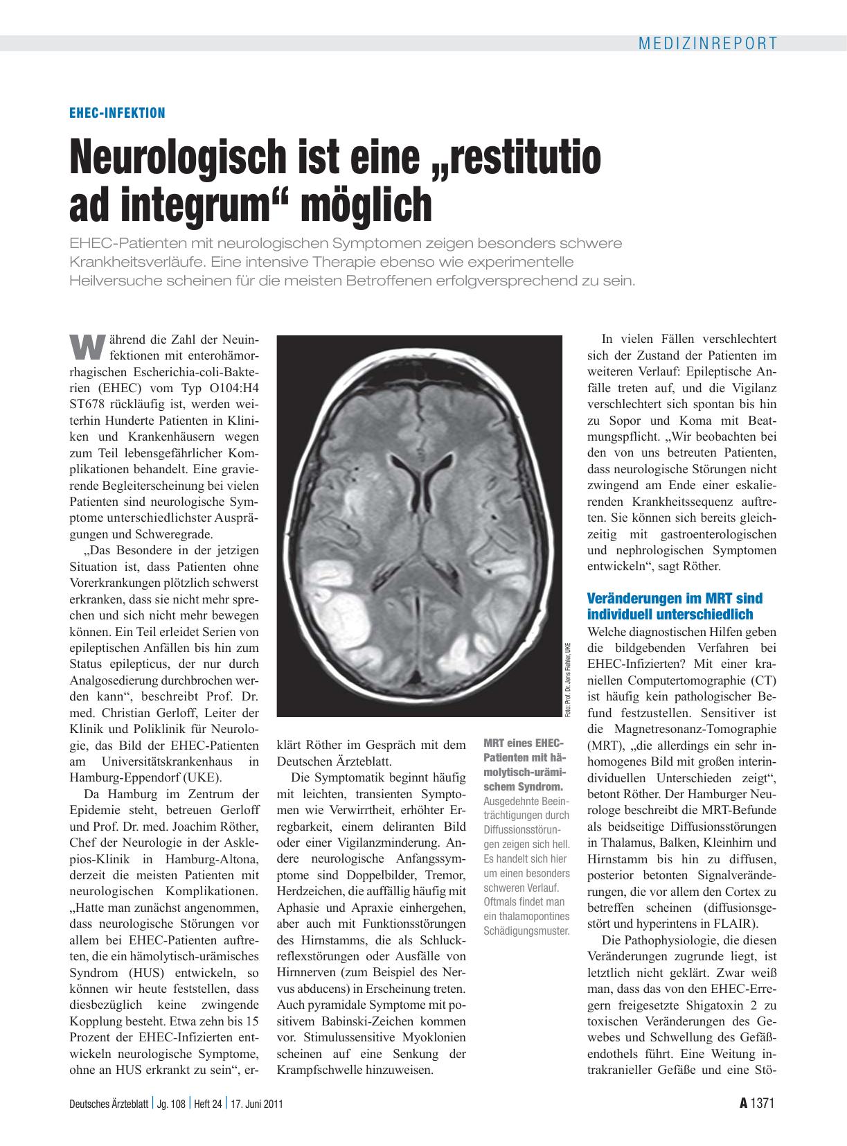 Vorschauseite 1: EHEC-Infektion: Neurologisch ist eine „restitutio ad integrum“ möglich